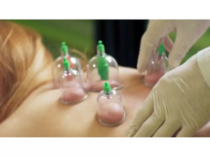 Set 12 Coppette Massaggio Terapia Tradizionale Cinese Coppettazione Sottovuoto