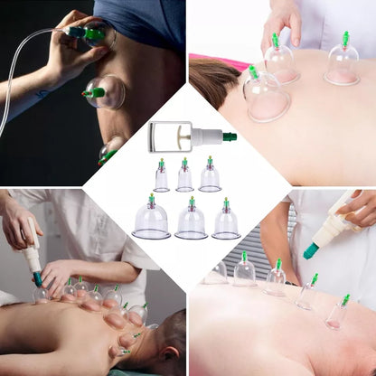 Set 12 Coppette Massaggio Terapia Tradizionale Cinese Coppettazione Sottovuoto
